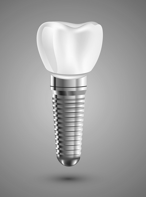 Implant3